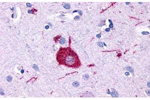 Anti-GPR116 antibody  ABIN1048696 IHC staining of human brain, neuron. (G Protein-Coupled Receptor 116 Antikörper  (Cytoplasmic Domain))