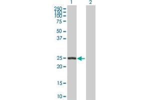 Western Blot analysis of ARHGDIB expression in transfected 293T cell line by ARHGDIB MaxPab polyclonal antibody. (ARHGDIB Antikörper  (AA 1-201))
