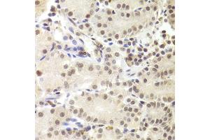 Immunohistochemistry of paraffin-embedded human stomach using PRPF3 Antibody (ABIN1876670) at dilution of 1:100 (40x lens). (PRPF3 Antikörper)