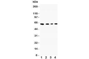Western blot testing of CADM1 antibody and Lane 1:  A549;  2: Jurkat;  3: Raji;  4: HeLa lysate. (CADM1 Antikörper  (N-Term))