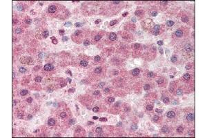 Image no. 1 for anti-Pyruvate Carboxylase (PC) (Internal Region) antibody (ABIN372799) (PC Antikörper  (Internal Region))