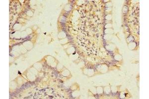Immunohistochemistry of paraffin-embedded human small intestine tissue using ABIN7165942 at dilution of 1:100