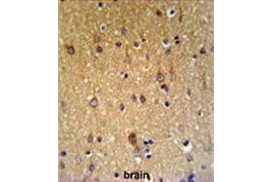 ZDHHC9 Antibody (C-term) IHC analysis in formalin fixed and paraffin embedded brain tissue followed by peroxidase conjugation of the secondary antibody and DAB staining. (ZDHHC9 Antikörper  (C-Term))