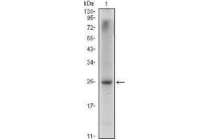 Western Blot showing NKX3A antibody used against LNCaP (1) cell lysate. (NKX3-1 Antikörper)