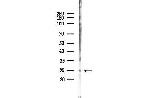 anti-Ephrin A3 (EFNA3) (C-Term) antibody