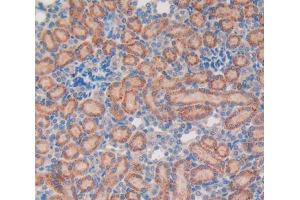 IHC-P analysis of kidney tissue, with DAB staining. (Vip Antikörper  (AA 34-157))