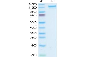 Human CD93/C1q R1 on Tris-Bis PAGE under reduced condition. (CD93 Protein (CD93) (AA 22-580) (Fc Tag))
