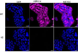 Immunocytochemical staining of HSHC cells using HSPA14 antibody (ABIN7798850), 1:1,000), Top panel: wild-type (WT), Bottom panal: HSPA14 shRNA knockdown (KD).