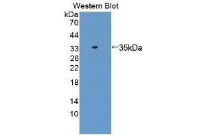 Western blot analysis of the recombinant protein. (CES1 Antikörper  (AA 18-299))
