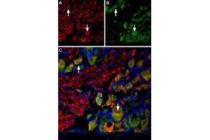 Multiplex staining of VGLUT2 and Neurokinin 1 Receptor in rat DRG - Immunohistochemical staining of perfusion-fixed frozen rat dorsal root ganglion (DRG) sections using Anti-VGLUT2-ATTO Fluor-594 Antibody (ABIN7043682), (1:60) and Anti-Neurokinin 1 Receptor (NK1R) (extracellular)-ATTO Fluor-488 Antibody (ABIN7043804), (1:60). (TACR1 Antikörper  (2nd Extracellular Loop) (Atto 488))