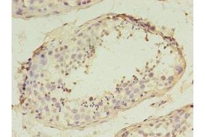 Immunohistochemistry of paraffin-embedded human testis tissue using ABIN7170468 at dilution of 1:100 (SPANXD Antikörper  (AA 1-97))