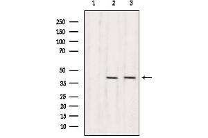 Western blot analysis of extracts from various samples, using RBM4 Antibody. (RBM4 Antikörper  (Internal Region))