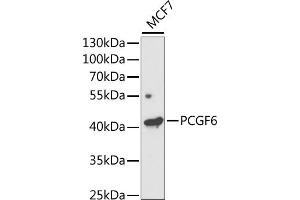 Western blot analysis of extracts of MCF7 cells, using PCGF6 antibody (ABIN6131076, ABIN6145311, ABIN6145312 and ABIN6221435) at 1:1000 dilution.