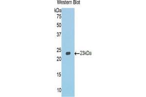 Western Blotting (WB) image for anti-Cadherin 1, Type 1, E-Cadherin (Epithelial) (CDH1) (AA 751-884) antibody (ABIN2901802)