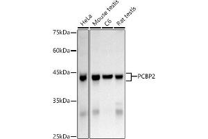 Western blot analysis of extracts of various cell lines, using hnRNP E2/PCBP2 Rabbit pAb antibody (ABIN3023339, ABIN3023340, ABIN3023341 and ABIN6219620) at 1:1000 dilution.