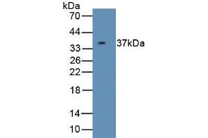 Detection of Recombinant CDK5, Human using Polyclonal Antibody to Cyclin Dependent Kinase 5 (CDK5) (CDK5 Antikörper  (AA 1-292))