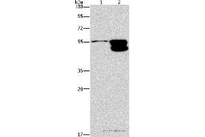 Western blot analysis of NIH/3T3 cell and mouse brain tissue, using CRHR2 Polyclonal Antibody at dilution of 1:650 (CRHR2 Antikörper)