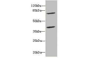 Western blot All lanes: CBFA2T2antibody at 2. (CBFA2T2 Antikörper  (AA 325-604))