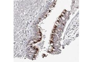 Immunohistochemical staining of human bronchus with SLC35D3 polyclonal antibody  shows strong cytoplasmic positivity, with a granular pattern, in respiratory epithelial cells.
