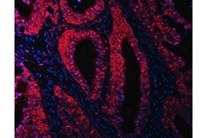 IF analysis of RBM15B using anti-RBM15B antibody (ABIN7600219).