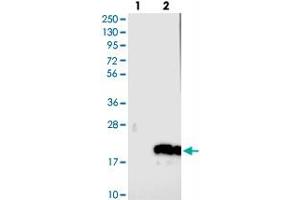 Western blot analysis of Lane 1: Negative control (vector only transfected HEK293T lysate), Lane 2: Over-expression Lysate (Co-expressed with a C-terminal myc-DDK tag (~3. (C14ORF177 Antikörper)