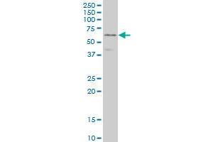 DPYSL3 monoclonal antibody (M01), clone 1B8 Western Blot analysis of DPYSL3 expression in Jurkat . (DPYSL3 Antikörper  (AA 457-555))