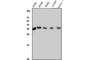 Western blot analysis of MED4 using anti-MED4 antibody (ABIN7600817). (MED4 Antikörper  (AA 24-254))