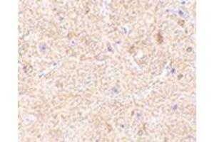Immunohistochemistry of VISA in mouse brain tissue with this product at 2. (MAVS Antikörper  (Middle Region))