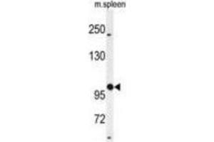 Western Blotting (WB) image for anti-UDP-N-Acetyl-alpha-D-Galactosamine:polypeptide N-Acetylgalactosaminyltransferase 5 (GalNAc-T5) (GALNT5) antibody (ABIN3004405) (GALNT5 Antikörper)