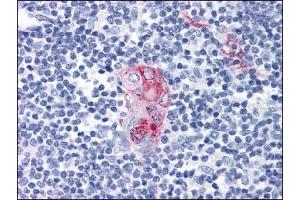 Immunohistochemistry (IHC) image for anti-CD1d Molecule (CD1D) antibody (ABIN614443) (CD1d Antikörper)