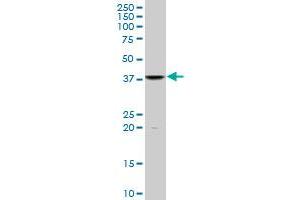 FUSIP1 monoclonal antibody (M07), clone 1G11. (SRSF10 Antikörper  (AA 1-100))