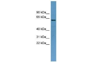 WB Suggested Anti-TOM1 Antibody Titration: 0.