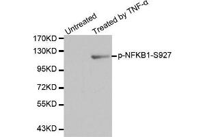 Western blot analysis of extracts from HL60 cells using Phospho-NFKB1-S927 antibody. (NFKB1 Antikörper  (pSer927))