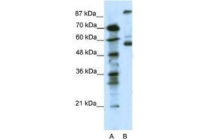 WB Suggested Anti-HTR7 Antibody Titration: 0. (HTR7 Antikörper  (N-Term))