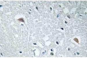 Immunohistochemistry analysis of Synapsin-1 Antibody in paraffin-embedded human brain tissue. (SYN1 Antikörper)