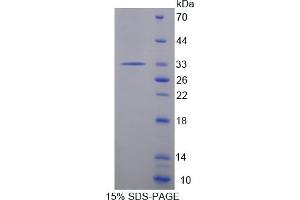 Image no. 1 for Protein tyrosine Phosphatase, Receptor Type, H (PTPRH) (AA 551-802) protein (His tag) (ABIN6238145) (PTPRH Protein (AA 551-802) (His tag))