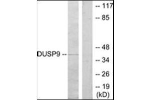 Western blot analysis of extracts from HeLa cells, using DUSP9 Antibody .
