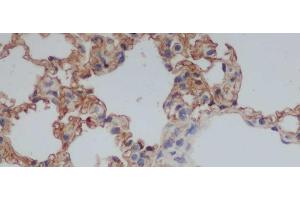 Immunohistochemistry of paraffin-embedded Rat lung using CD244 Polyclonal Antibody at dilution of 1:50