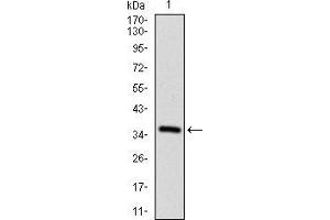 Western blot analysis using CD7 mAb against human CD7 recombinant protein. (CD7 Antikörper  (AA 72-175))