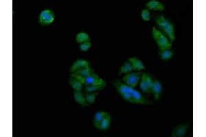 Immunofluorescence staining of HepG2 cells with ABIN7163230 at 1:200, counter-stained with DAPI. (PICALM Antikörper  (AA 517-624))
