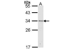 WB Image Sample (30 ug of whole cell lysate) A: Molt-4 , 12% SDS PAGE antibody diluted at 1:1000 (RPA2 Antikörper)