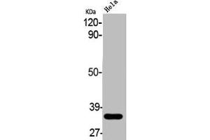 Western Blot analysis of HELA cells using ABCC13 Polyclonal Antibody (ABCC13 Antikörper  (Internal Region))