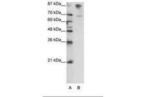 Image no. 3 for anti-HKR1, GLI-Kruppel Zinc Finger Family Member (HKR1) (C-Term) antibody (ABIN6736165) (HKR1 Antikörper  (C-Term))