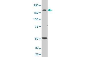 SCN8A monoclonal antibody (M04), clone 4G7 Western Blot analysis of SCN8A expression in NIH/3T3 (SCN8A Antikörper  (AA 1854-1951))