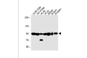 All lanes : Anti-NOD1 Antibody (C-term) at 1:1000 dilution Lane 1: CCRF-CEM whole cell lysate Lane 2: NCI- whole cell lysate Lane 3: HL-60 whole cell lysate Lane 4: HT-29 whole cell lysate Lane 5: S whole cell lysate Lane 6: Mouse heart lysate Lane 7: Mouse spleen lysate Lysates/proteins at 20 μg per lane. (NOD1 Antikörper  (C-Term))