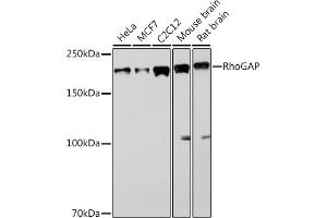 Western blot analysis of extracts of various cell lines, using RhoGAP Rabbit mAb (ABIN1682830, ABIN3016006, ABIN3016007 and ABIN7101474) at 1:1000 dilution. (ARHGAP5 Antikörper)