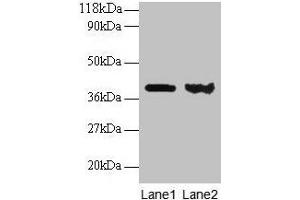 Western blot All lanes: ARHGDIA antibody at 2 μg/mL Lane 1: EC109 whole cell lysate Lane 2: 293T whole cell lysate Secondary Goat polyclonal to rabbit IgG at 1/15000 dilution Predicted band size: 24, 19 kDa Observed band size: 40 kDa (ARHGDIA Antikörper  (AA 2-204))