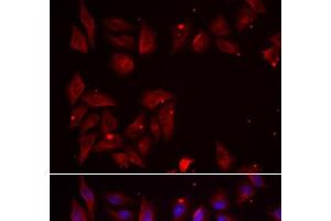 Immunofluorescence analysis of U2OS cells using PDXK Polyclonal Antibody (PDXK Antikörper)