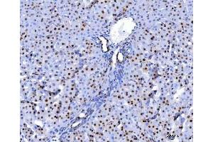 IHC analysis of U1A/SNRPA using anti-U1A/SNRPA antibody (ABIN7600891). (SNRPA1 Antikörper  (AA 25-218))