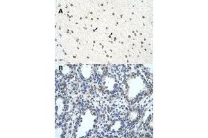 Immunohistochemical staining (Formalin-fixed paraffin-embedded sections) of human brain (A) and lung (B) with BLZF1 polyclonal antibody  at 4-8 ug/mL working concentration. (BLZF1 Antikörper  (C-Term))
